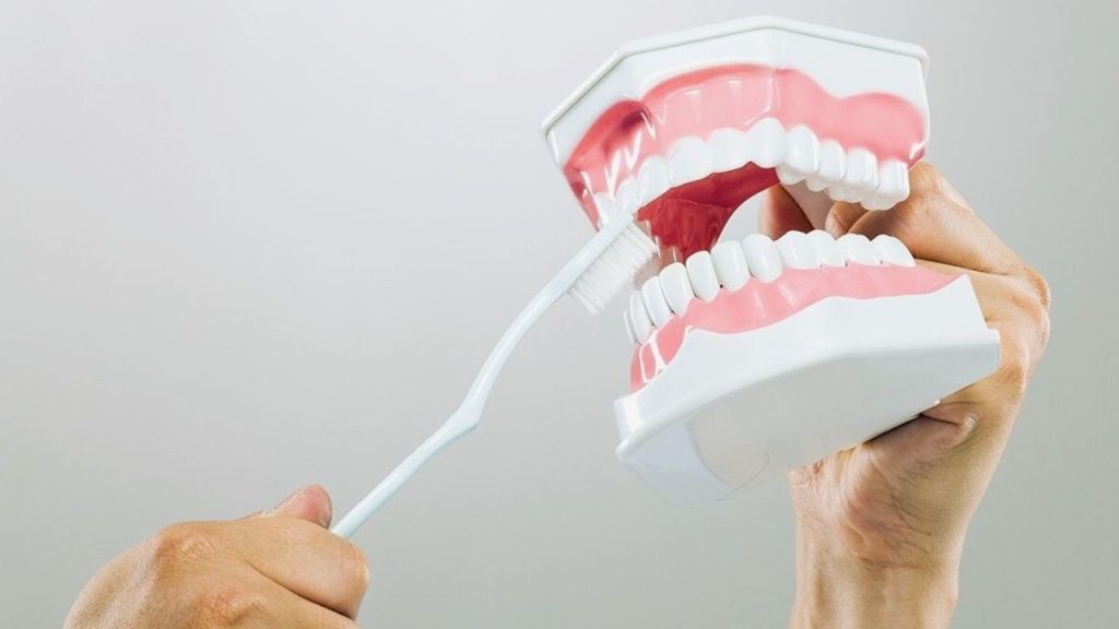 ¿Cuáles son los cuidados y restricciones posteriores a la colocación de un implante dental? 1 colocación de un implante dental