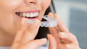 ¿Por qué cada vez más personas eligen Invisalign?