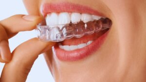 Adiós a los brackets: Prueba la ortodoncia invisible